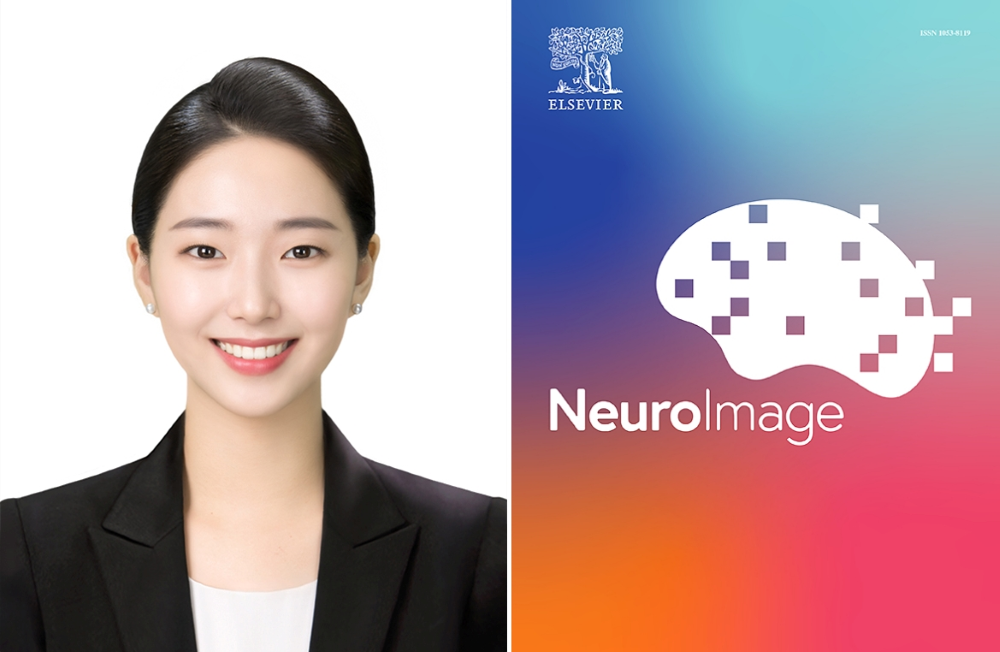 바이오메디컬공학부 이가원 박사과정생, 세계적 저널 NeuroImage에 AI 기반 MRI 정규화 기술 논문 게재 이미지